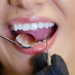 why-you-shouldnt-skip-your-bi-annual-dental-checkup