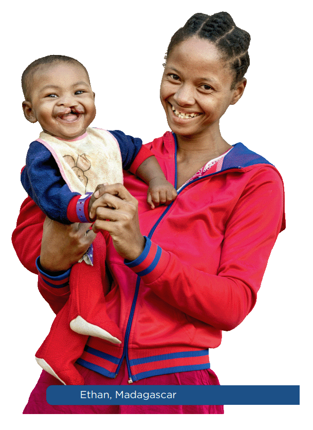 A mother and her child &mdash; Operation Smile